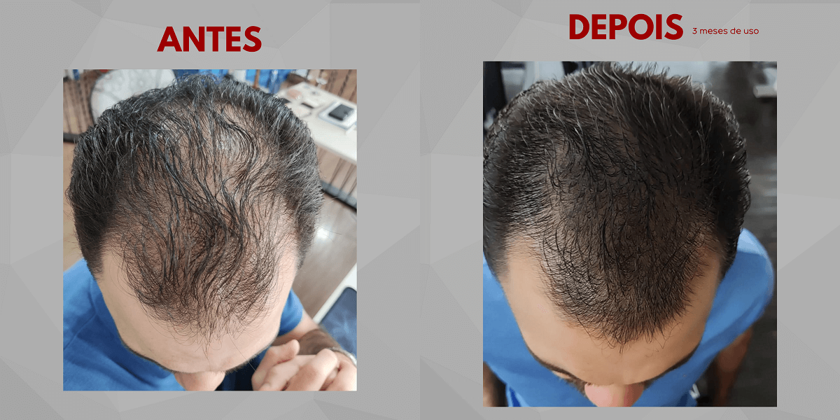 Antes e Depois